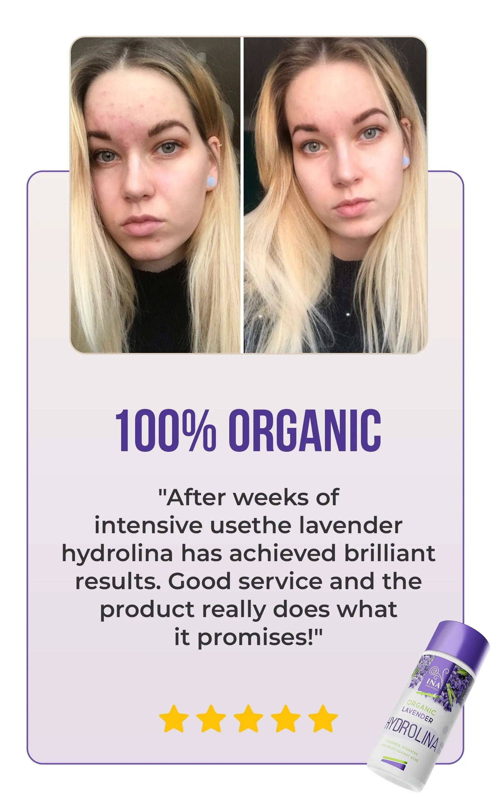 Organic Lavender water - Hydrolina for Acne