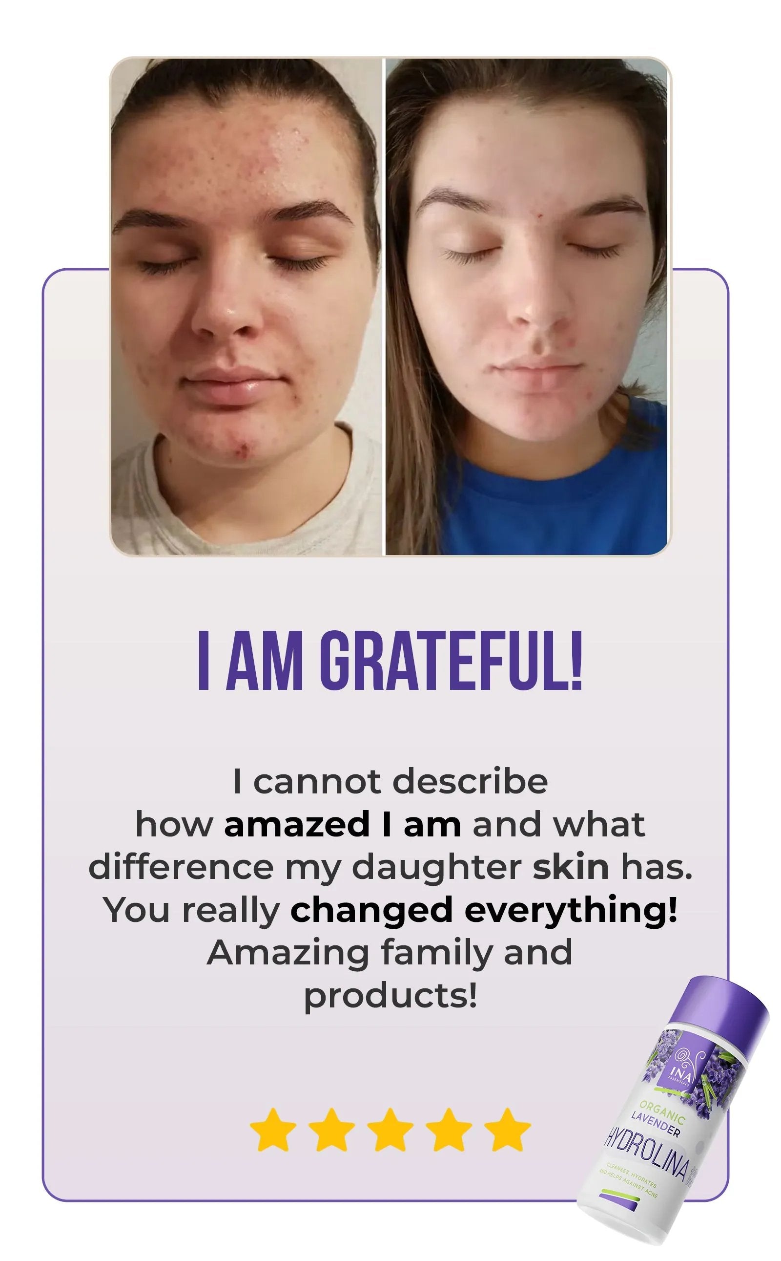 Organic Lavender water - Hydrolina for Acne
