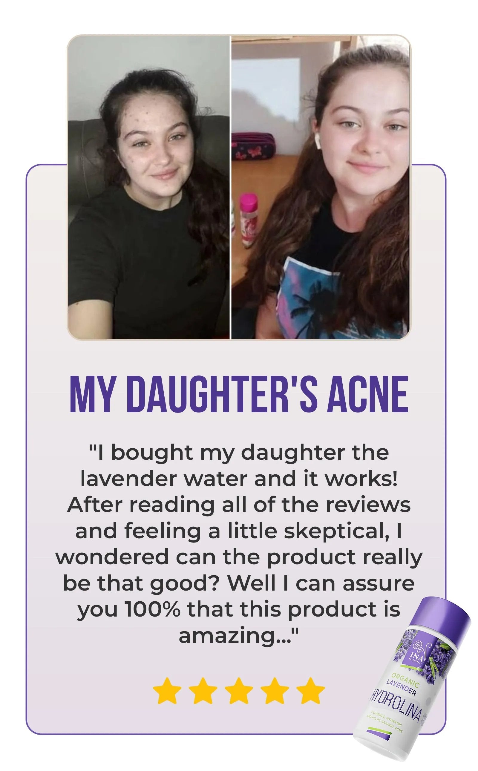 Organic Lavender water - Hydrolina for Acne