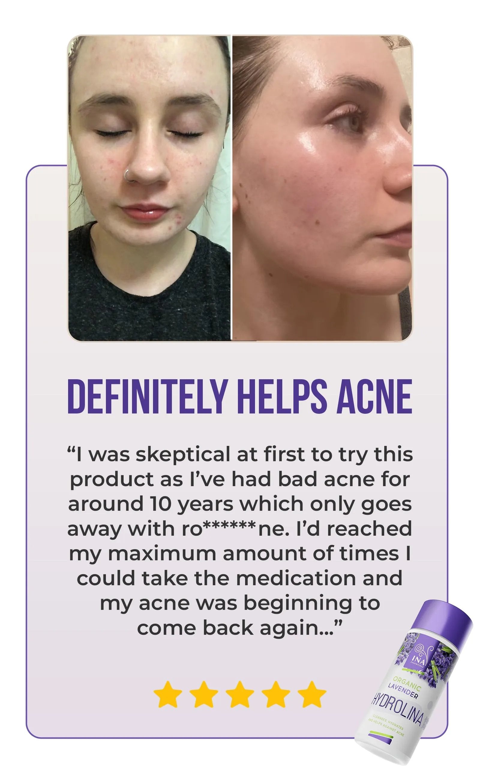 Organic Lavender water - Hydrolina for Acne